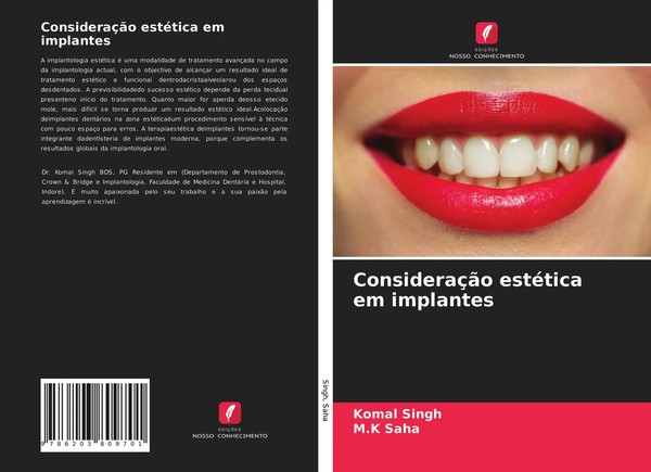 Komal Singh (U. A.) | ConsideraçãO EstéTica Em Implantes | Taschenbuch (2021)-image