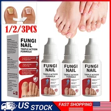 Fungi-Nail Anti-Fungal Liquid Solution Kills Fungus That Can Lead To Nail