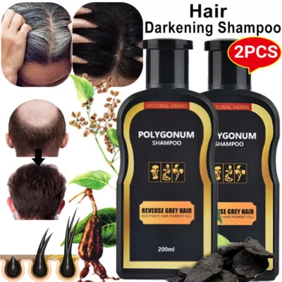 MS.DEAR 2PCS Polygonum Multiflorum Shampoo Reverse Grey Hair Darkening Natural Shampoo~