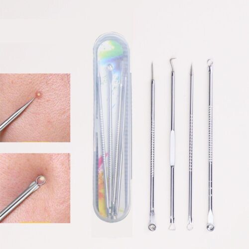 4 In 1 Blackhead Remover Stainless Ingrown Hair Removal Kit Acne Closed Needle - Picture 1 of 7