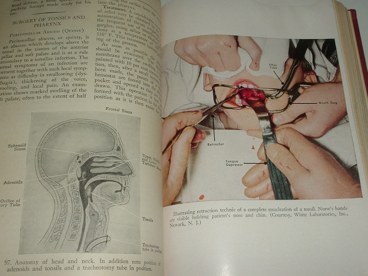 Picture 16 of 18