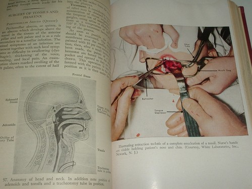LQQK vintage 1946 hb. SURGICAL NURSING w/279 illustrations - Picture 16 of 18