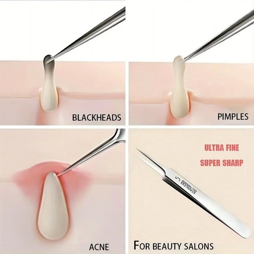 1 Pack No.5 Fine Acne Tweezers Blackhead Remover Needle Tool for Skin Care - Picture 18 of 24