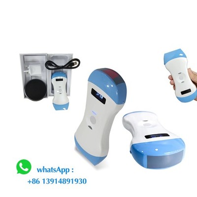 Wireless Scanner Color Doppler Ultrasound 158Elements 3 in 1 Probe Linear/Convex