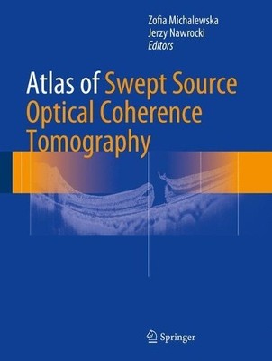 Atlas of Swept Source Optical Coherence Tomography - 9783319498393