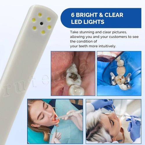 1 Set Dental USB Intraoral Camera 1080P 1/3" HD CMOS COB White Light - Picture 10 of 15