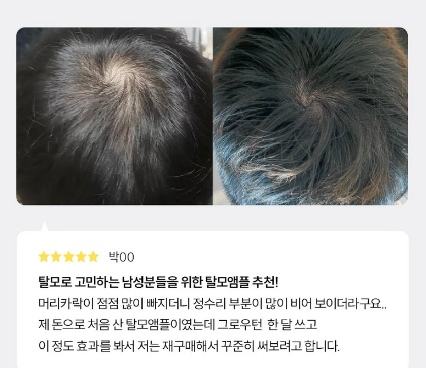 [LilyEve] Grow:Turn Exosome Ampoule 抗脱发头皮护理 100 毫升 K-Beauty — 第 4/4 张图片