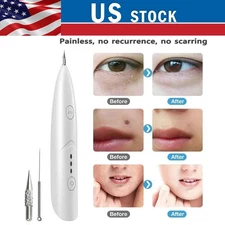 Laser Plasma Pen Mole Removal Dark Spot Remover Skin Wart Tag Tattoo Anti-Aging