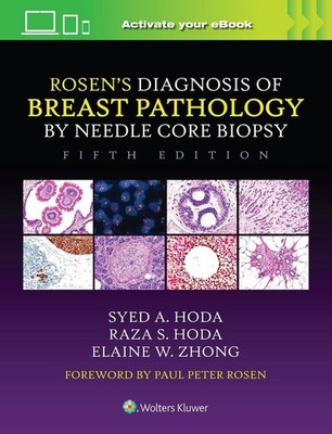 Rosen's Diagnosis of Breast Pathology by Needle Core Biopsy by Syed A. Hoda Hard