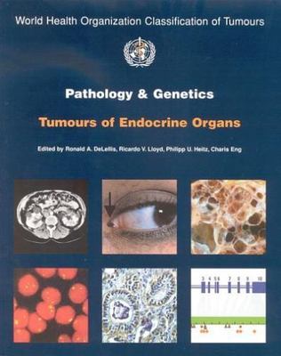 Pathology and Genetics of Tumours of Endocrine Organs [OP] (Medicine)