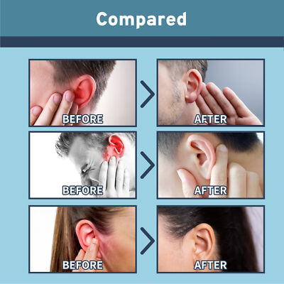 Ear Tinnitus And Jaw Clenching Jaw Noise In Ear 2pcs Tinnitus Ear - Main Image