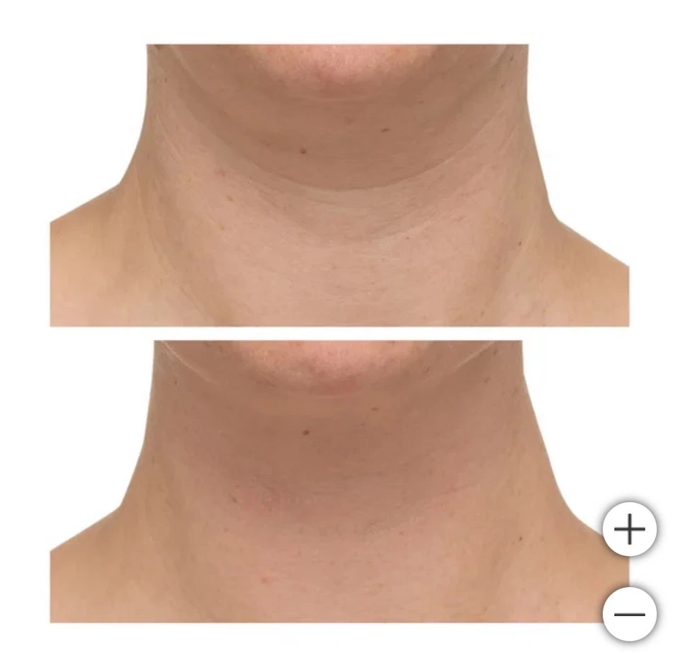 StriVectin TL Advanced Tightening Neck Cream Plus, 1 oz, 2-pack - Image 2 of 3