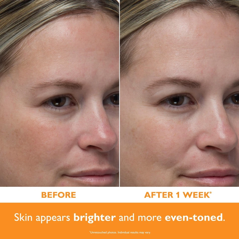 	Peter Thomas Roth | Potent-C™ Power Serum	 - Image 3 of 4