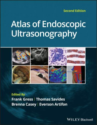 Atlas of Endoscopic Ultrasonography by Thomas J. Savides (2022, Hardcover)
