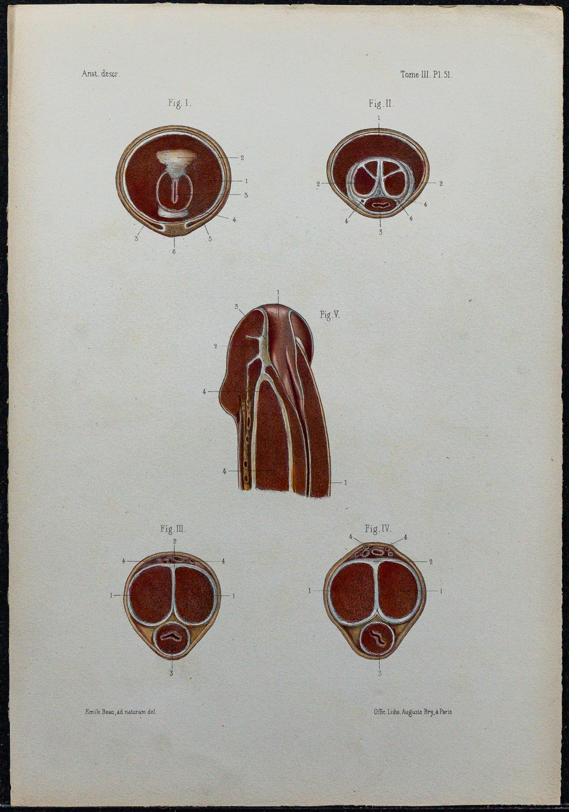 1866 - Penis & Harnröhre - Anatomie & Urologie - Alte Gravur