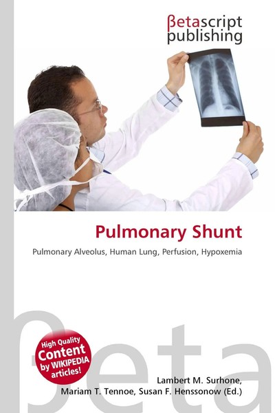 Lambert M. Surhone (U. A.) | Pulmonary Shunt | Taschenbuch | Englisch (2026)-image