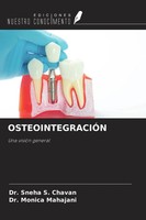 Sneha S. Chavan (U. A.) | OsteointegraciÓN | Taschenbuch | Spanisch (2022)