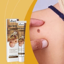 Bee Venom Skin Tag Removal Treatment Cream Body Care Mole Corn Wart Remover