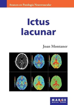 Ictus lacunar by Joan Montaner Paperback Book