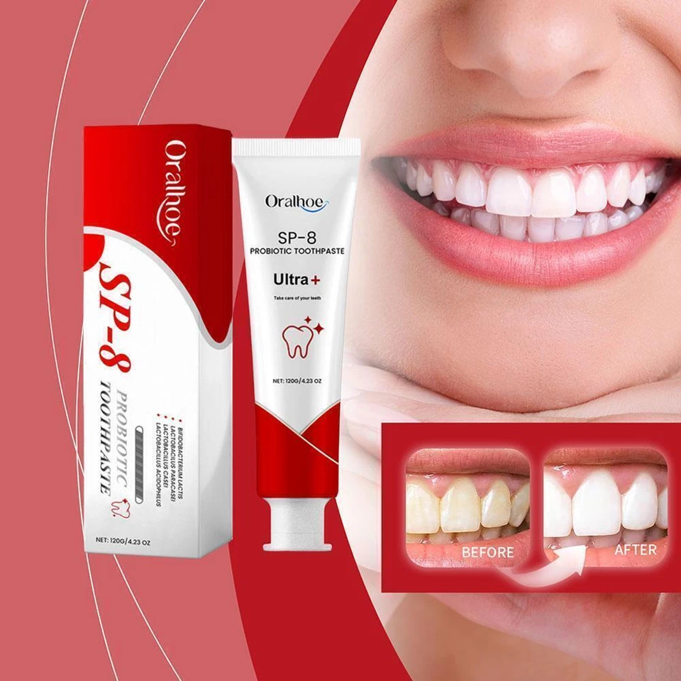 Dentifricio probiotico SP-8, dentifricio sbiancante SP-8 White 2024 Quick R F3P9 - Image 2 of 4