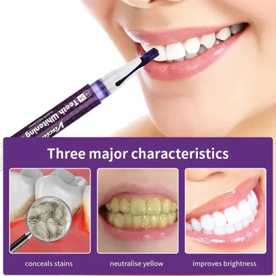 VACLAV Teeth Whitening Pen Extra Strong White Tooth Whitener Delicate Stain Remover' UK