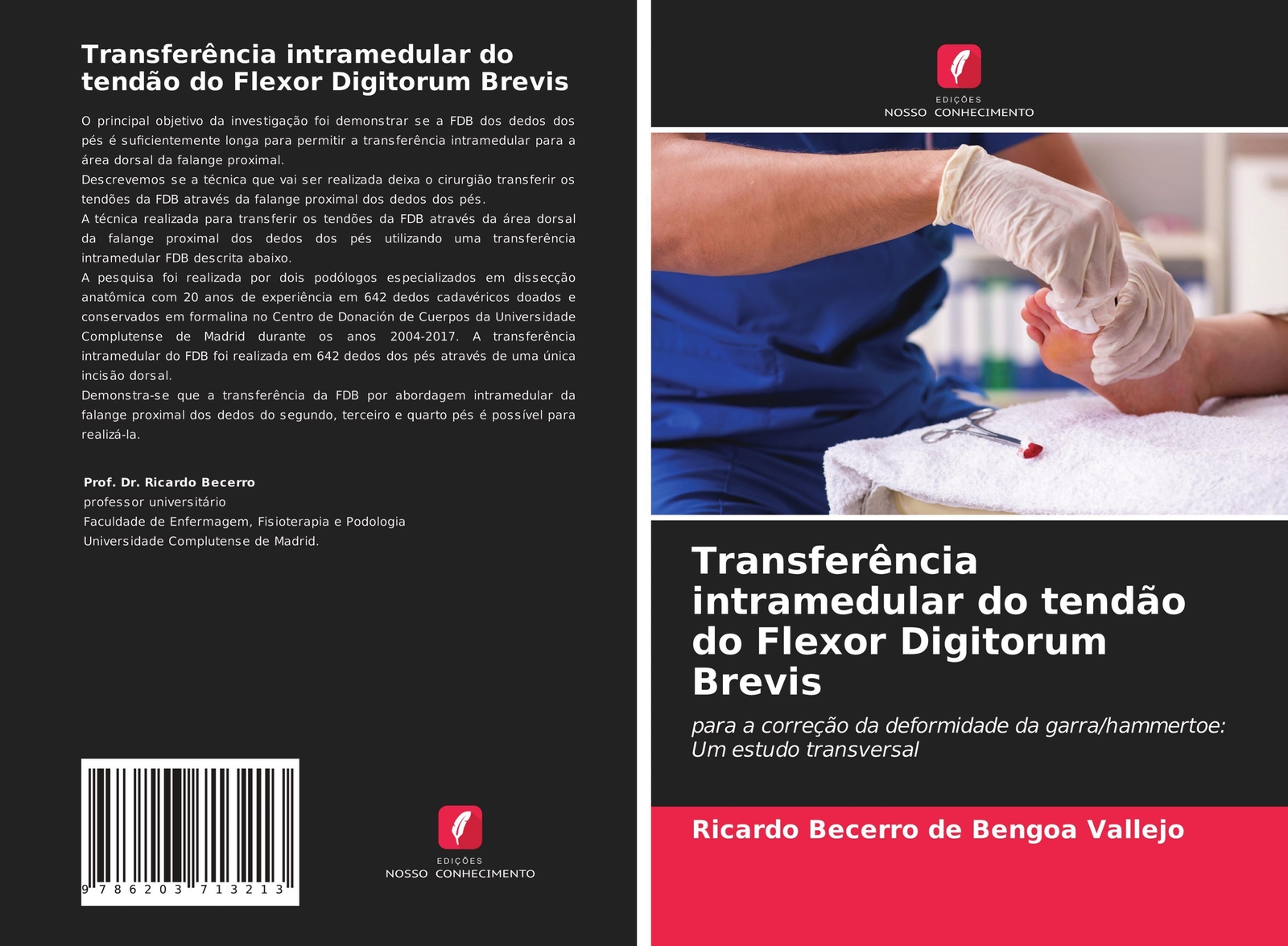 Transferência Intramedular Do Tendão Do Flexor Digitorum Brevis