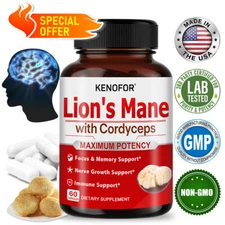 Lion's Mane 10:1 Extract, 450mg Strength, 60 Vegan Capsules, lmmune Support