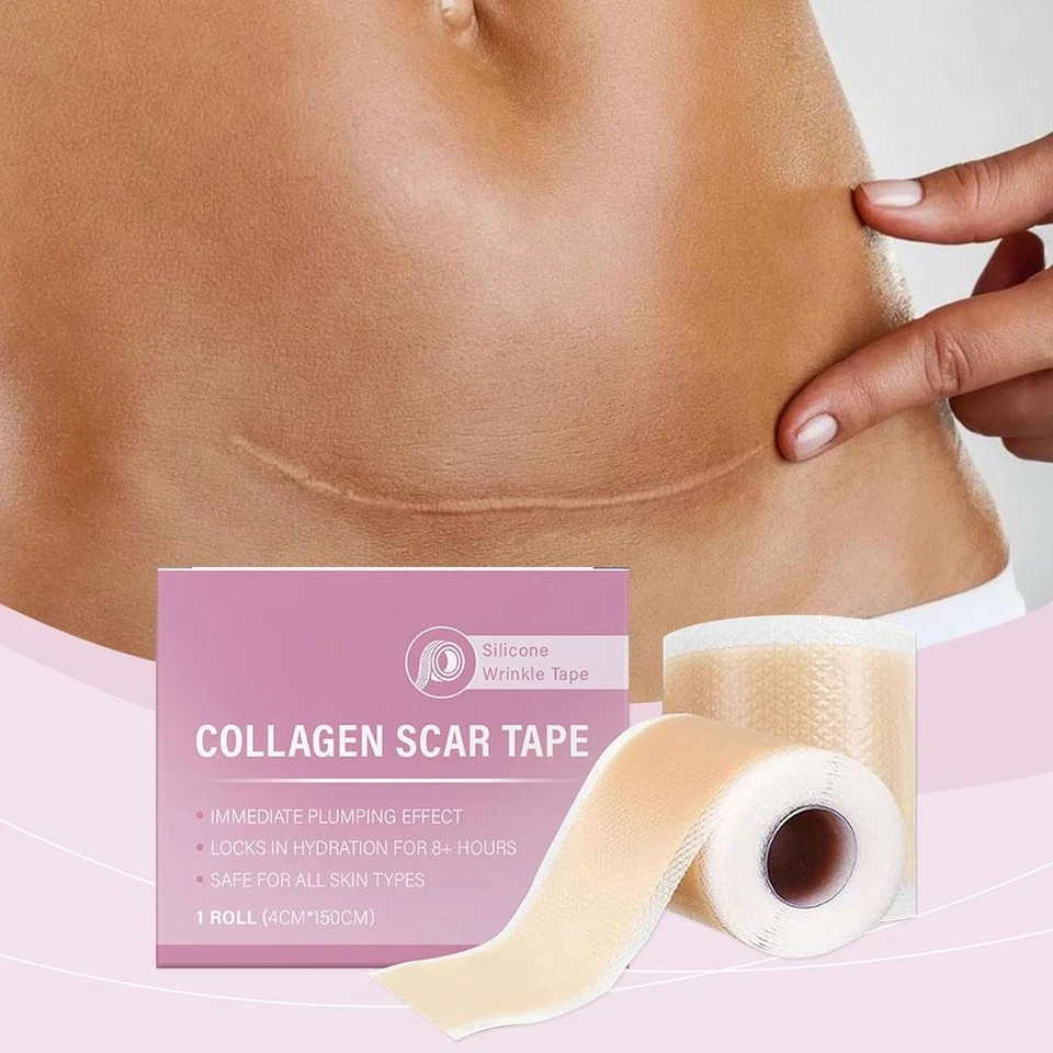 1-3x Collagen Scar Tape For Face, Losveo Silicone Scar S heets For Face Wrinkles - Image 4 of 4