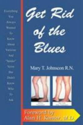 Get Rid of the Blues : Everything You Always Wanted to Know About Varicose & ...