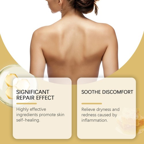 1-5Pcs Bee Venom Skin Salve Ointment Stick, Bee Venom Moisturizing Cream 30g - Picture 11 of 16