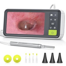 Digital Otoscope with Gyroscope, 4.5 Inches Screen, 3.9mm Ear Scope Camera wi...