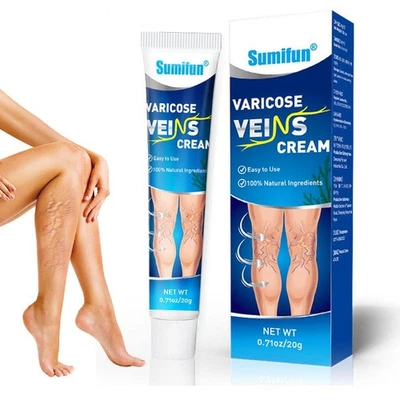 NEW Varicose Vein Cream Herbal Varic ose Veins Treatment Cream Spider_/ I4C7
