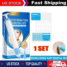 Painless,safe automatic removal of skin tags-for mole wart removal RemovalPenSet