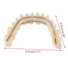 Complete Snap-On Denture Set - Upper and Lower False Teeth with Veneer Covers
