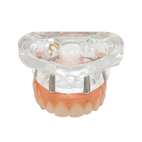 Multiple Types Dental Teeth Model Ortho Implant Practice Teaching Demo Model - Picture 270 of 276