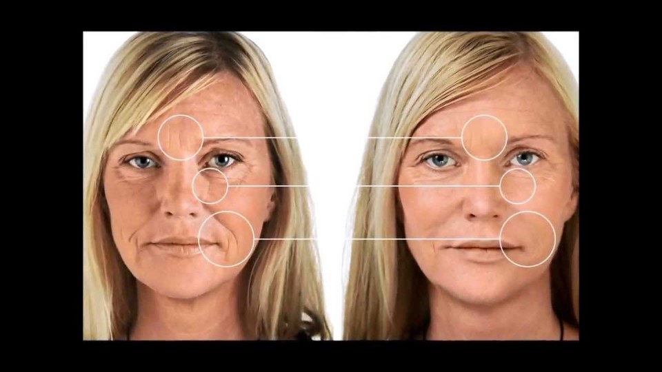 metabolism fat burner diet pills - ACAI BERRY – ANTI-WRINKLE COMBO 2B ...