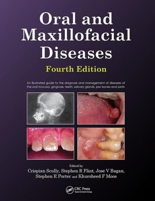 Oral and Maxillofacial Diseases : An Illustrated Guide to the Diagnosis and M...