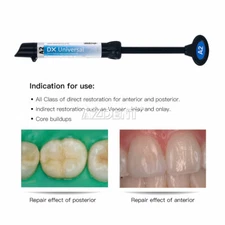 Dentex Dental Universal Light Cure Composite Resin Refill Syringe A2 Shade 4g/pc
