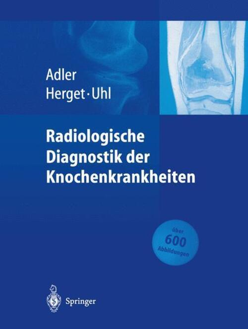 Thumbnail - Radiologische Diagnostik Der Knochenkrankheiten | Claus-peter Adler