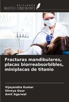 Fracturas Mandibulares, Placas Biorreabsorbibles, Miniplacas De Titanio Vijayend