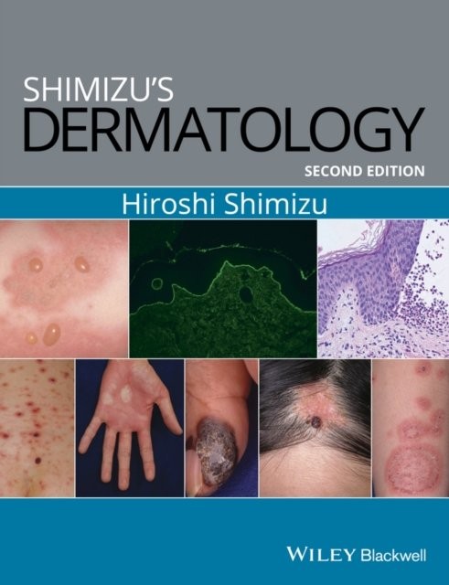 Shimizu′s Dermatology, 2e Shimizu Paperback Wiley–Blackwell 9781119099055