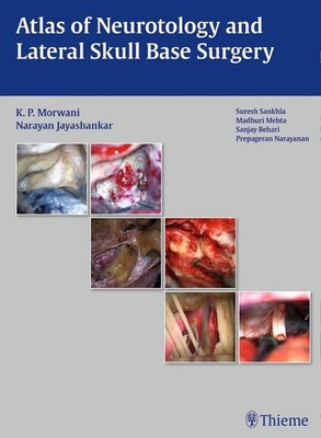 Atlas of Neurotology and Lateral Skull Base Surgery | deutsch, englisch