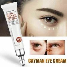 1-5PCS Eye Cream Remove Eye Bags Dark Circles Anti Wrinkle Depuffing Firming