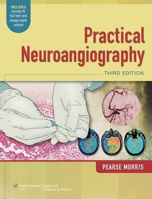 Practical Neuroangiography - 9781451144154