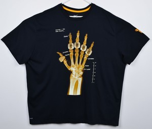kobe x ray t shirt