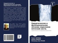 Hirurgicheskoe I Funkcional'noe Lechenie Perelomow Pqtochnoj Kosti. Marwa Mayel