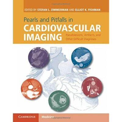 Pearls Pitfalls Cardiovascular Imaging Pseudolesions Artifacts  9781107023727 VG