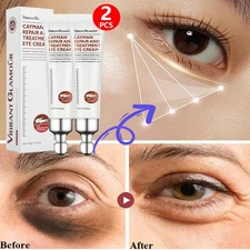 2~Under Eye Cream Remove Dark Circles Bags Face Lines Ageless Wrinkles Puffy Eye