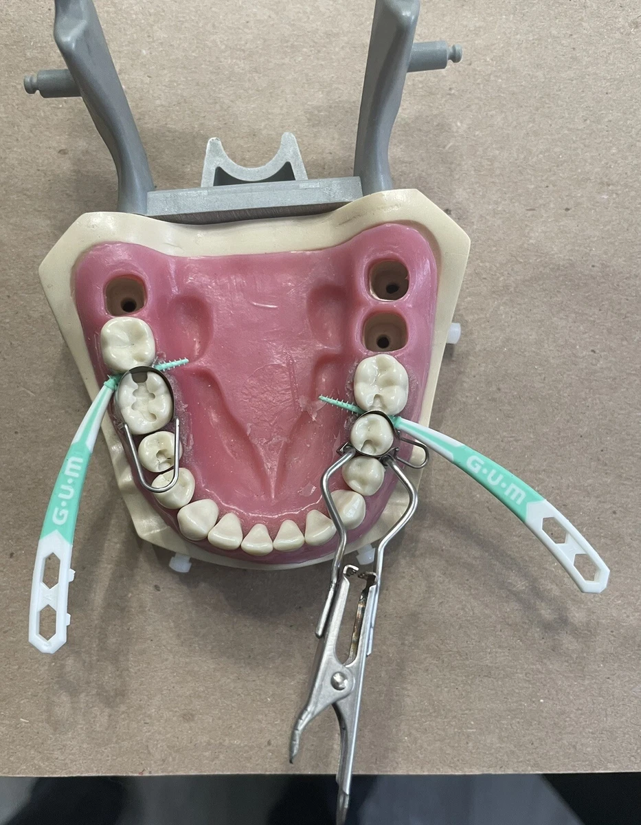 Dental Matrix Bands/ The U Dental Molars The ICT University