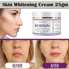 KOJIC ACID Skin Whitening Lightening Brightening Bleaching/Spot Fade Cream